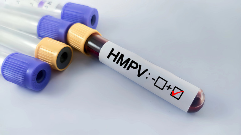 u kiyevi zafiksovano pershij vipadok zaxvoryuvannya na metapnevmovirus 678074189fce6 У Києві зафіксовано перший випадок захворювання на метапневмовірус