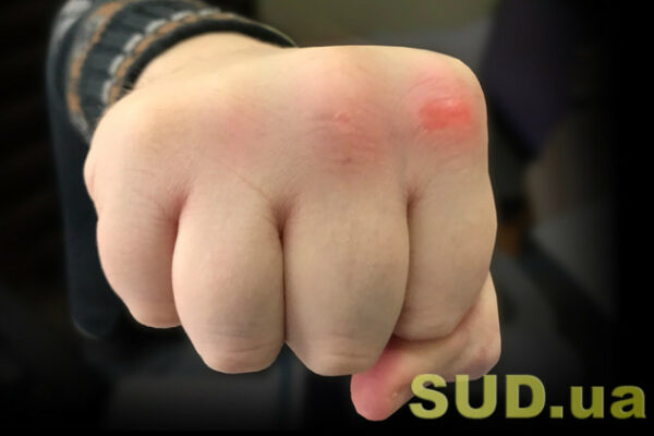 na cherkashhini zatrimali dvox osib za napad na pracivnikiv tck 692f6fcc70d65 На Черкащині затримали двох осіб за напад на працівників ТЦК