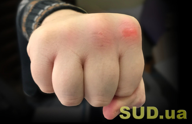 na cherkashhini zatrimali dvox osib za napad na pracivnikiv tck 692f6fcc70d65 На Черкащині затримали двох осіб за напад на працівників ТЦК